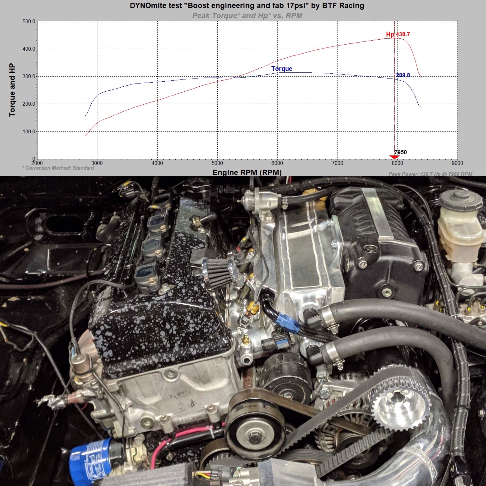 S2000 Whipple 1.6L Supercharger Kit